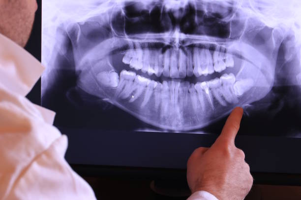 Best Emergency Dental Surgery in Trussville, AL
